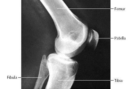 Lateral Knee X-rays