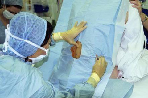 Caesarean Section