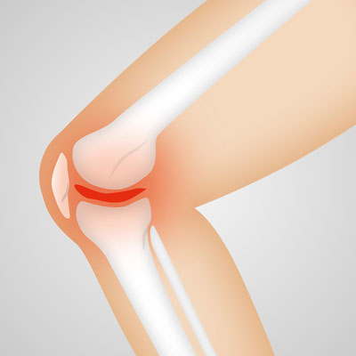 knee Pain