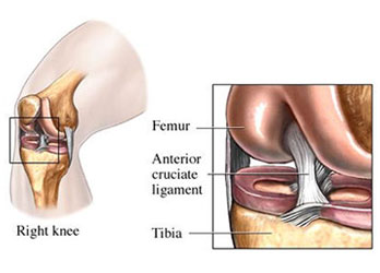 Anterior Cruciate Ligament Location