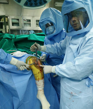 Surgery Partial Knee Replacement