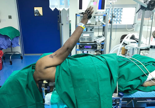 Shoulder Arthroscopy Position