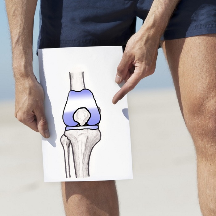 Knee Joint Replacement Surgery