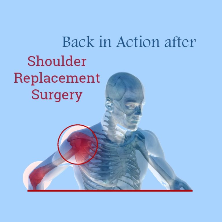 Total Shoulder Replacement Surgery in Mumbai Knee & Shoulder Surgeon