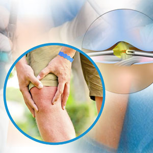 Need to Know About How Did You Get a Total Knee Replacement in Mumbai?