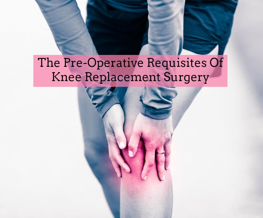 Pre-Operative Requisites Of Knee Replacement Surgery