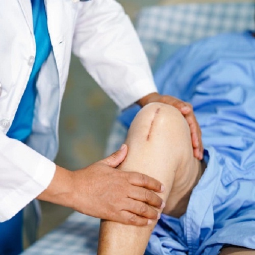 How To Manage Infection After Knee Replacement Surgery