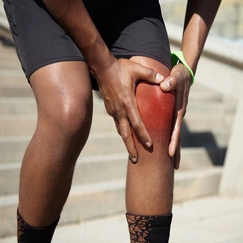 Sports Injuries Of The Knee Joint