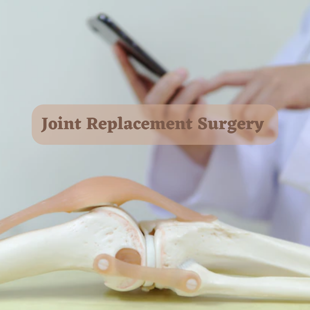 Joint Replacement Surgery - A Life-Changing Procedure