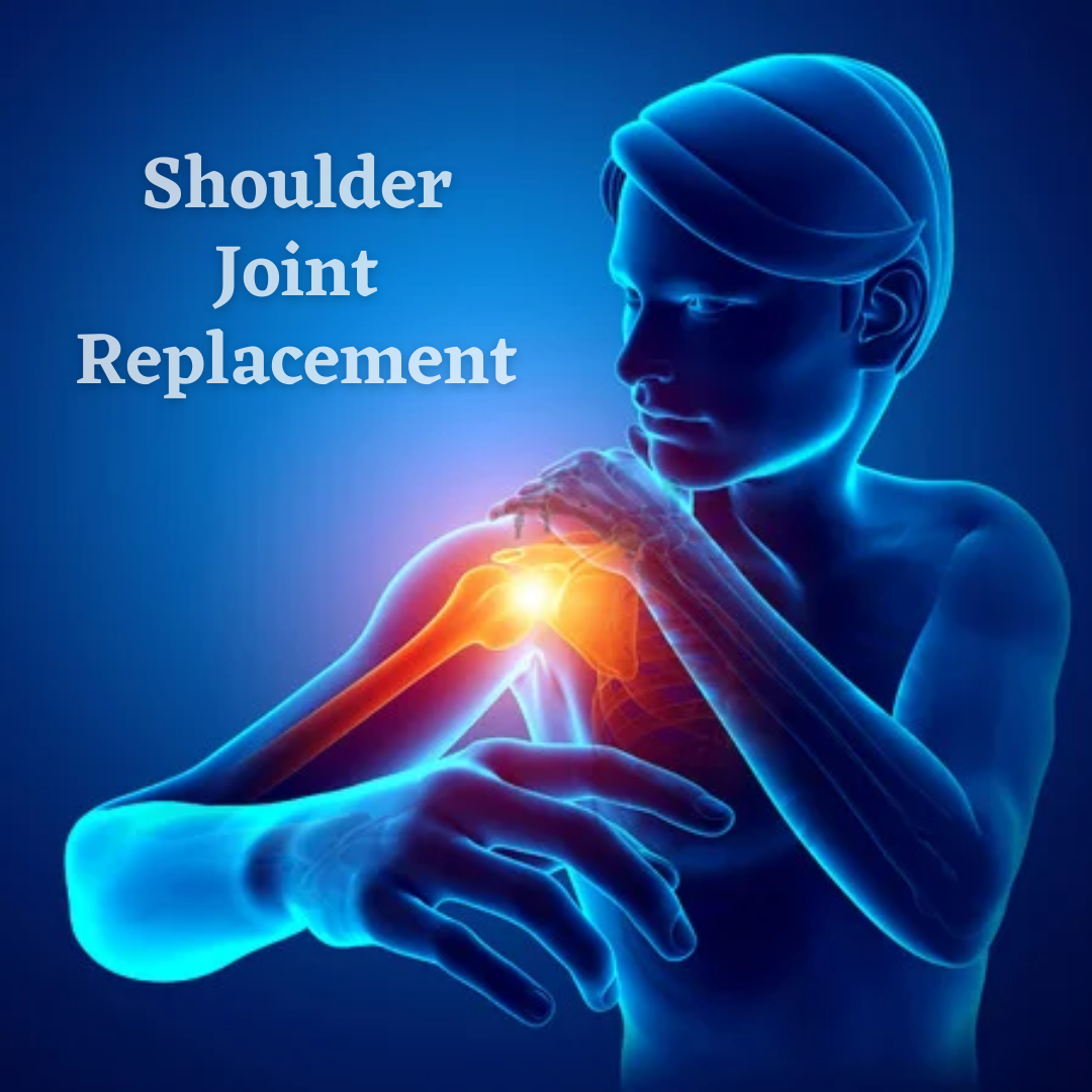 Restrictions And Care After Shoulder Joint Replacement