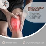 Dislocated Kneecap: Symptoms, Treatments & Recovery