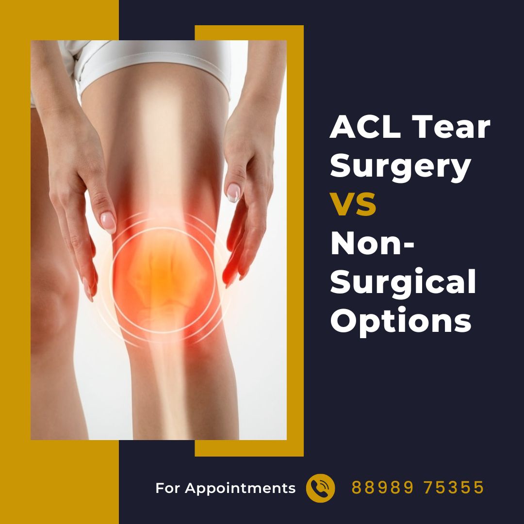 ACL Tear Surgery vs. Non-Surgical Options
