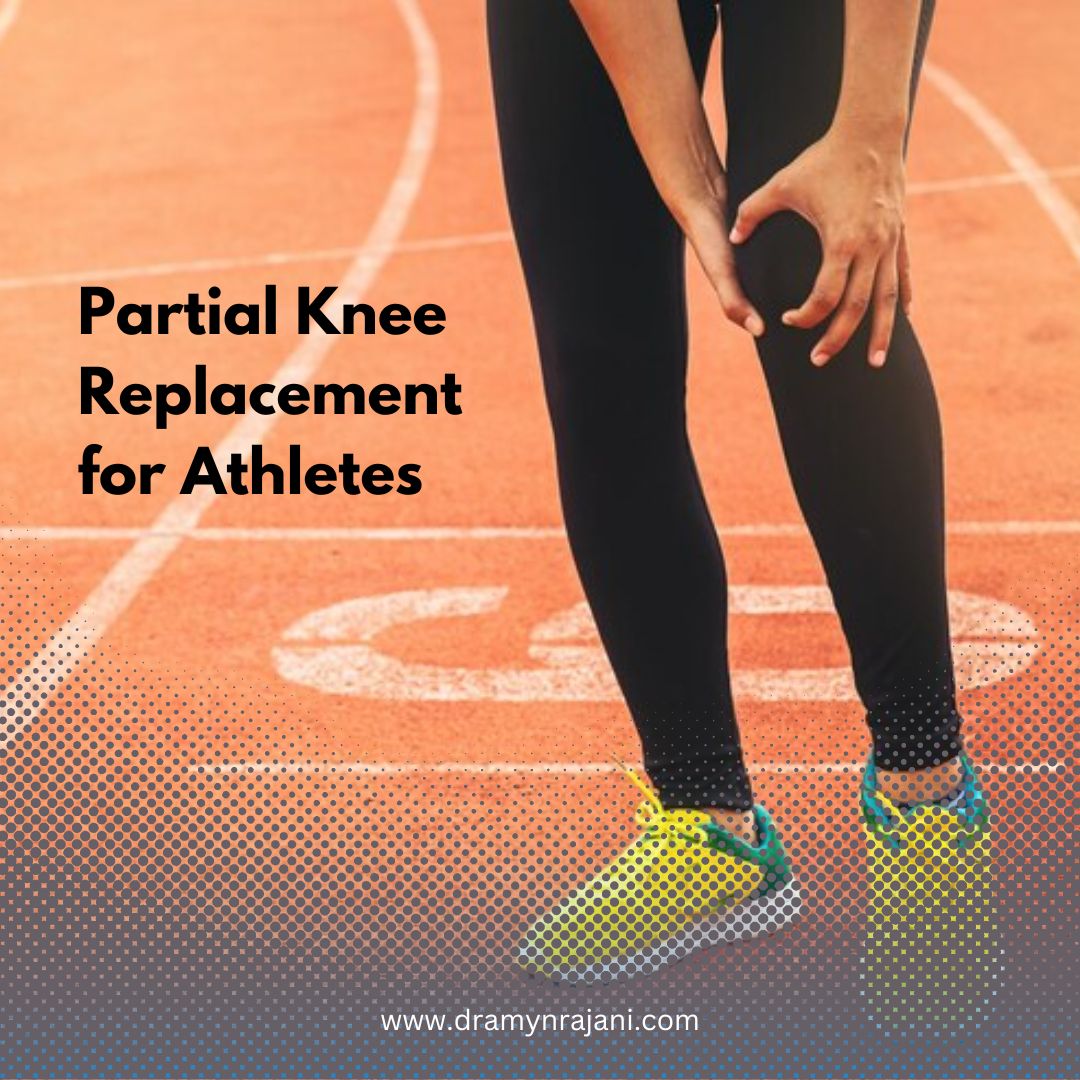 Partial Knee Replacement for Athletes