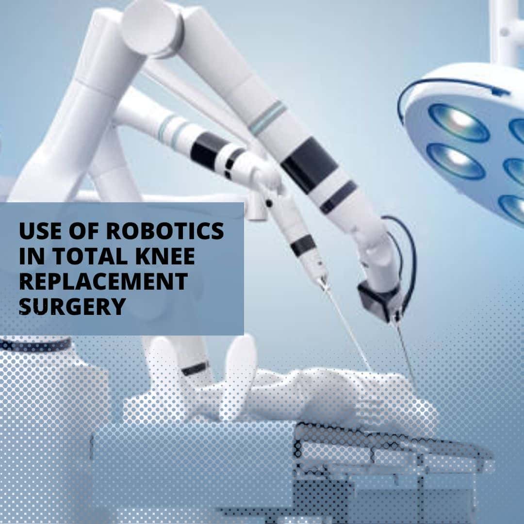 Use of Robotics in Total Knee Replacement Surgery