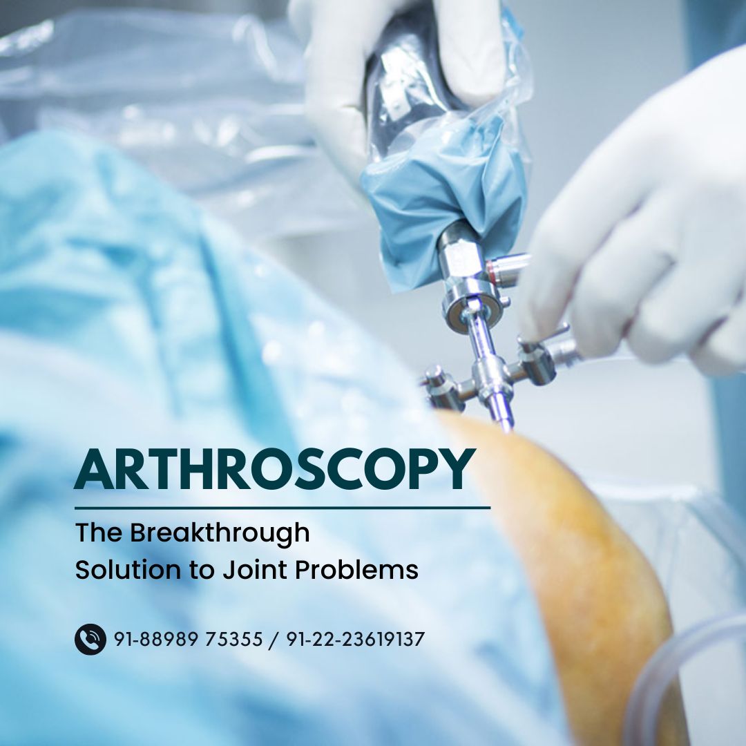 Arthroscopy - The Breakthrough Solution to Joint Problems
