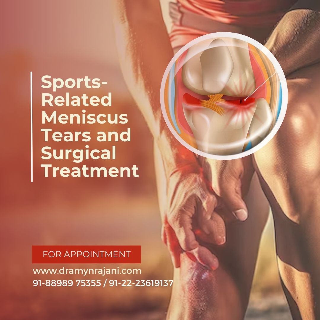 Sports-Related Meniscus Tears and Surgical Treatment