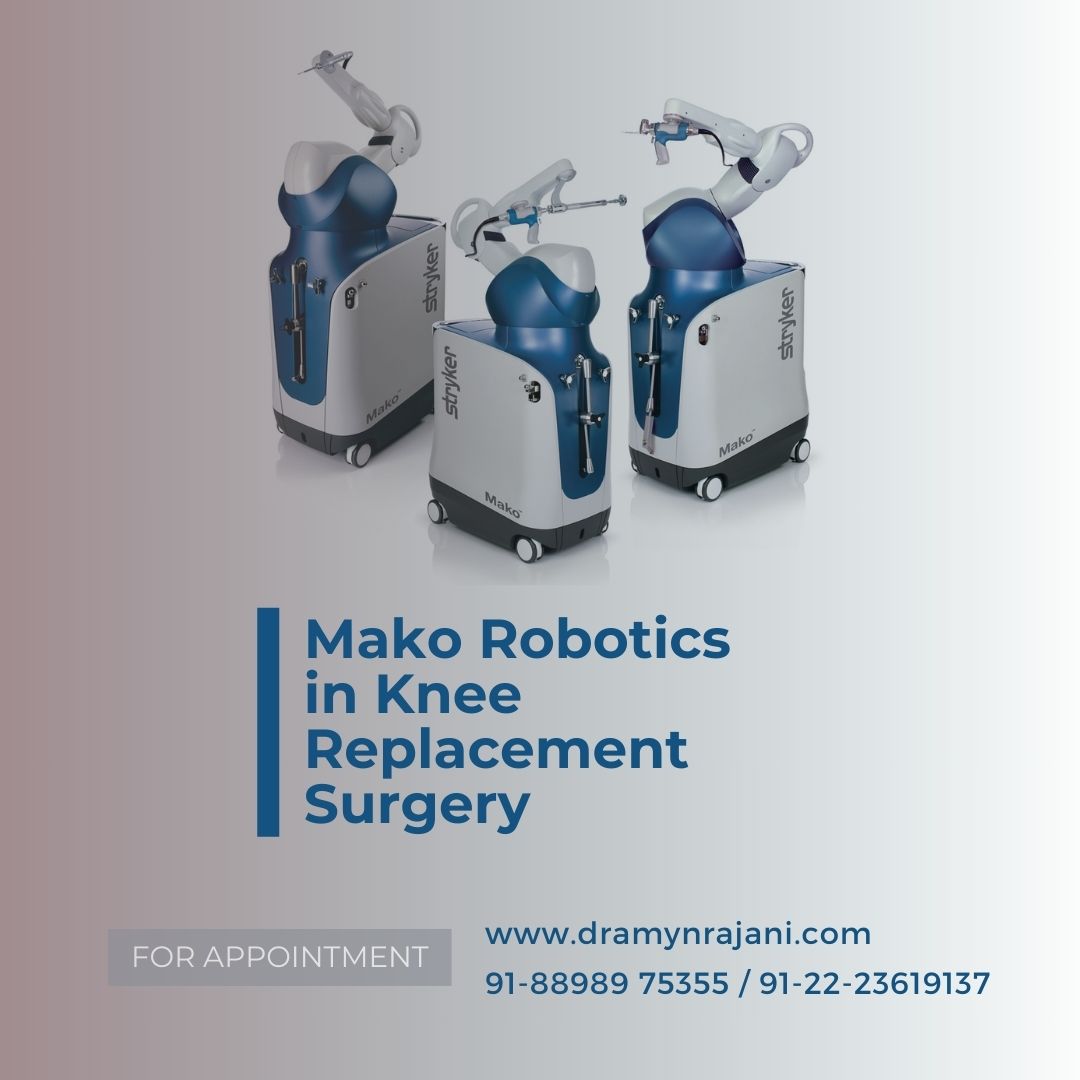Mako Robotics in Knee Replacement Surgery