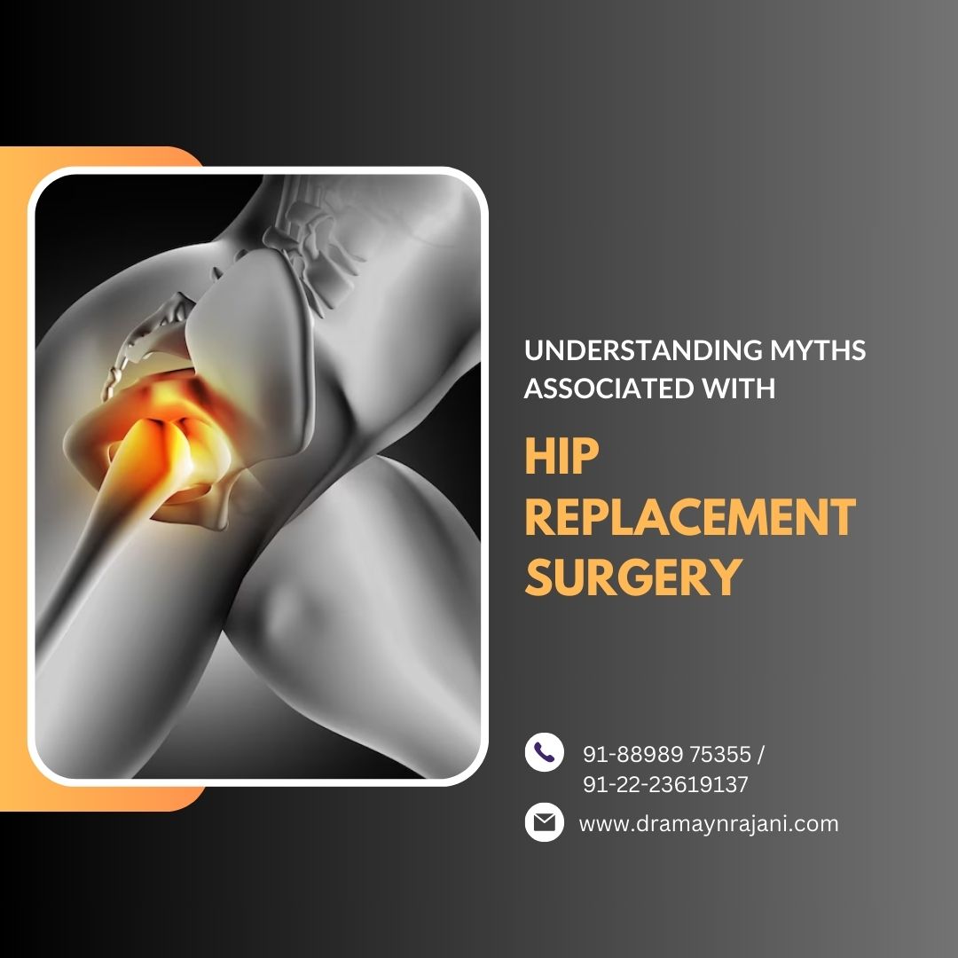 Understanding Myths Associated with Hip Replacement Surgery