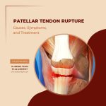 Patellar Tendon Rupture - Causes, Symptoms, and Treatment