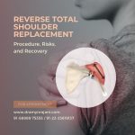 Reverse Total Shoulder Replacement - Procedure, Risks, and Recovery
