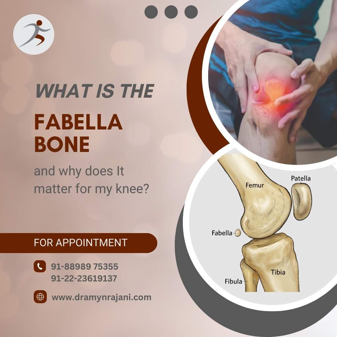 What Is The Fabella Bone And Why Does It Matter For My Knee What Is The Fabella Bone And Why Does It Matter For My Knee