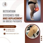 Retention Stitches for Knee Replacement in Obese Patients