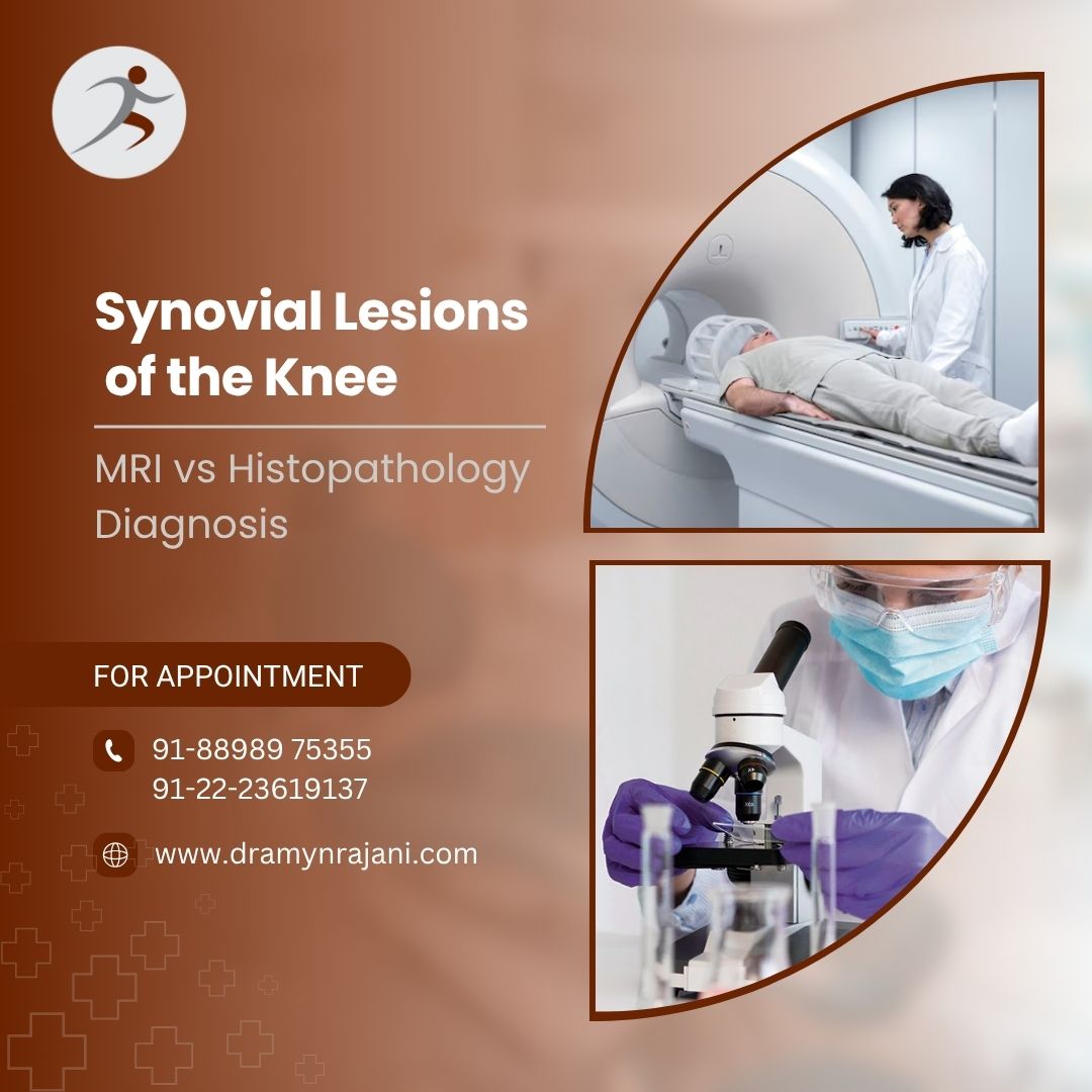 Synovial Lesions of the Knee - MRI vs Histopathology Diagnosis