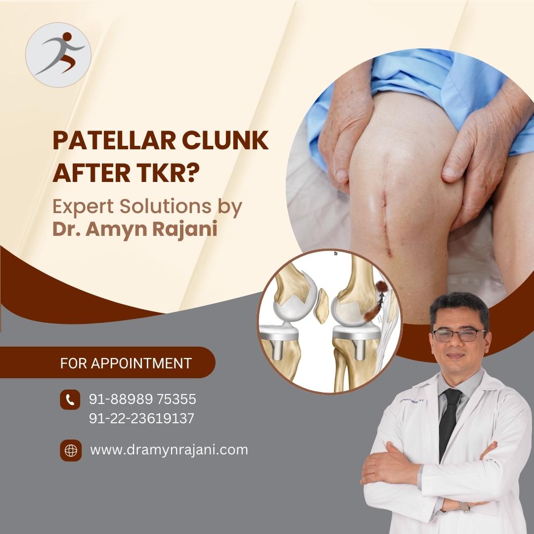 Patellar Clunk After TKR - Expert Solutions by Dr. Amyn Rajani