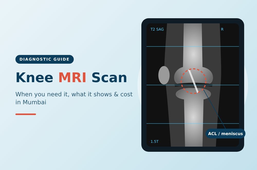 Knee MRI scan image showing the knee joint, ACL and meniscus